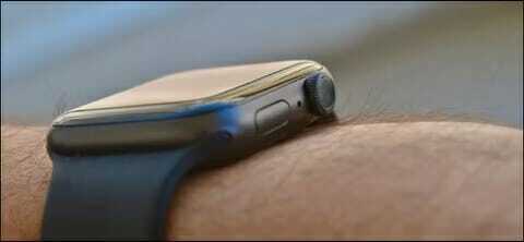 Side Button on Apple Watch  