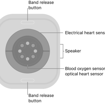 The back of Apple Watch Series 10, with the band release buttons at top and bottom, the electrical heart sensors, optical heart sensors, and blood oxygen sensors in the middle, and the speaker on the side.